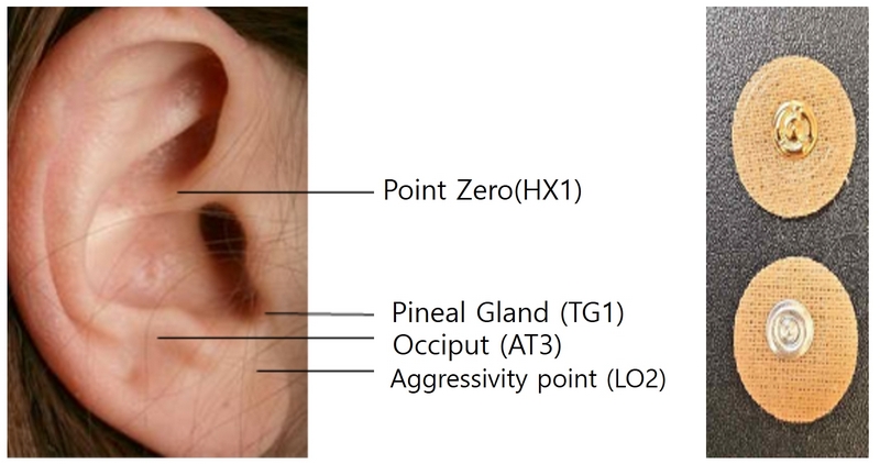 Figure 2.